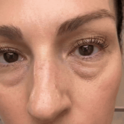 Coopmate® 𝐂𝐚𝐥𝐜𝐢𝐮𝐦 𝐕𝐨𝐥𝐮𝐦𝐞 Botox Balm