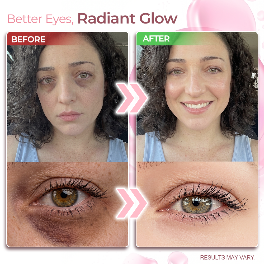 Coopmate® PDRN Peptide Eye Cream